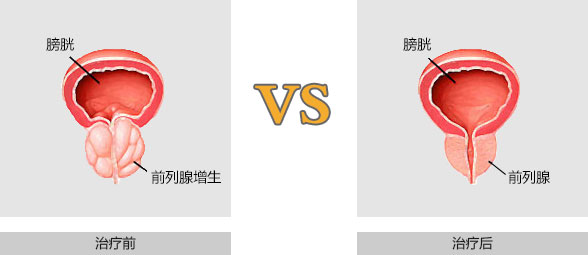上饶中山男科医院