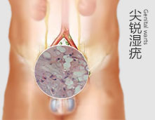 上饶中山男科医院