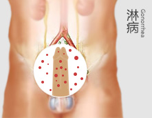 上饶中山男科医院